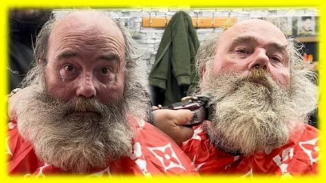 5 Ways To Fix Santas Bare Beard