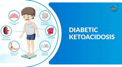 5 Ways To Manage Diabetic Ketoacidosis