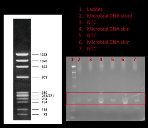 5 Ways To Optimize No Template Control Pcr